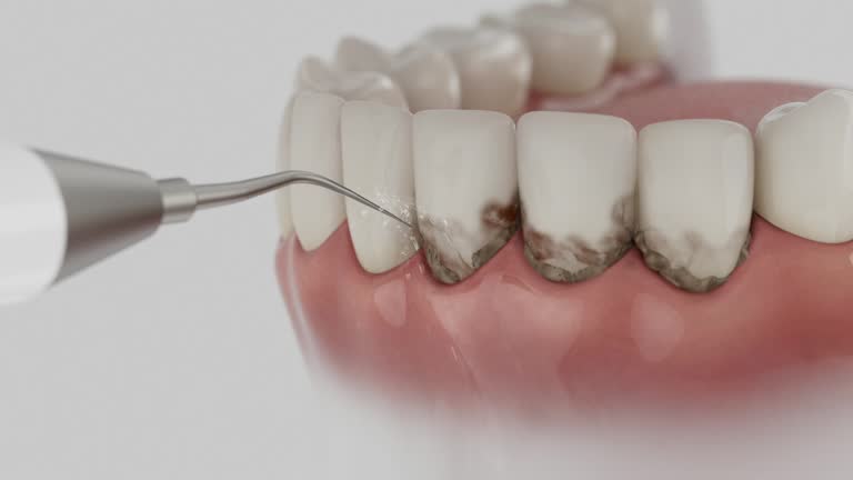 Reliable Dental Implants contractor in Landmark, AR by Smile Center Dentistry